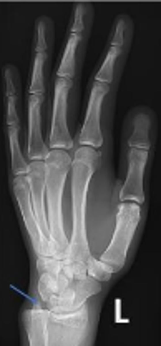 <p>What is the arrow pointing to?</p>