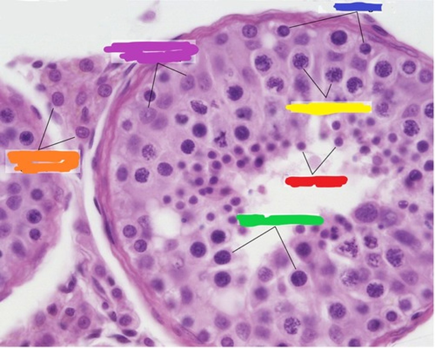 <p>1n2c - green label</p>