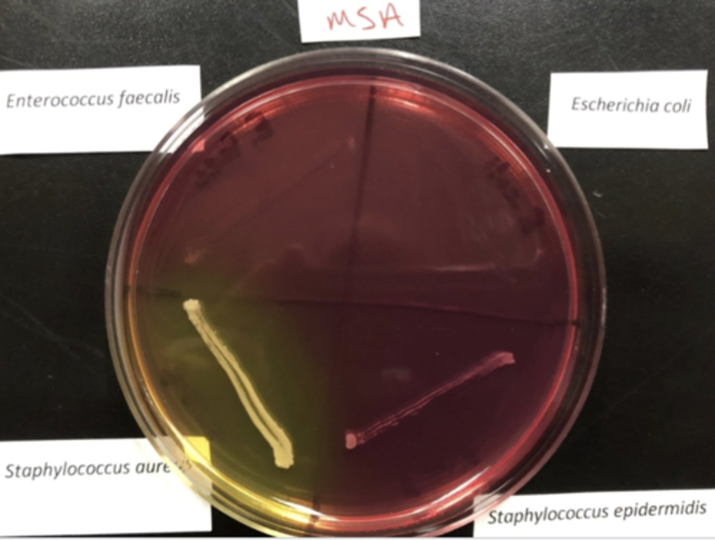 <p>Not inhibited by NaCl</p><p>- possible stap aureus</p>