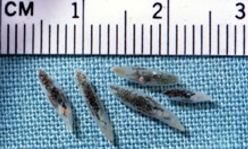 <ul><li><p><strong>Common name:</strong> Lancet liver fluke</p></li><li><p><strong>DH:</strong> Cattle, sheep, goats</p></li><li><p><strong>IH:</strong> Land snails → ants</p></li><li><p><strong>Loc:</strong> Bile ducts</p></li><li><p><strong>LC:</strong> Indirect — ingestion of ants containing metacercariae</p></li><li><p><strong>CS:</strong> Usually subclinical; heavy infections → weight loss, anemia, liver damage</p></li><li><p><strong>DX:</strong> Fecal sedimentation (eggs)</p></li><li><p><strong>TX:</strong> Albendazole</p></li><li><p><strong>PREV:</strong> Pasture management, avoid ant-contaminated feed</p></li><li><p><strong>ZOON:</strong> Rare</p></li></ul><p></p>