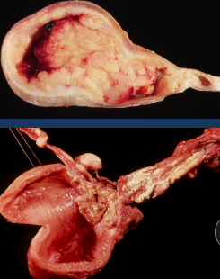 <p><span style="background-color: transparent;"><strong>Bladder Tumors</strong></span></p>