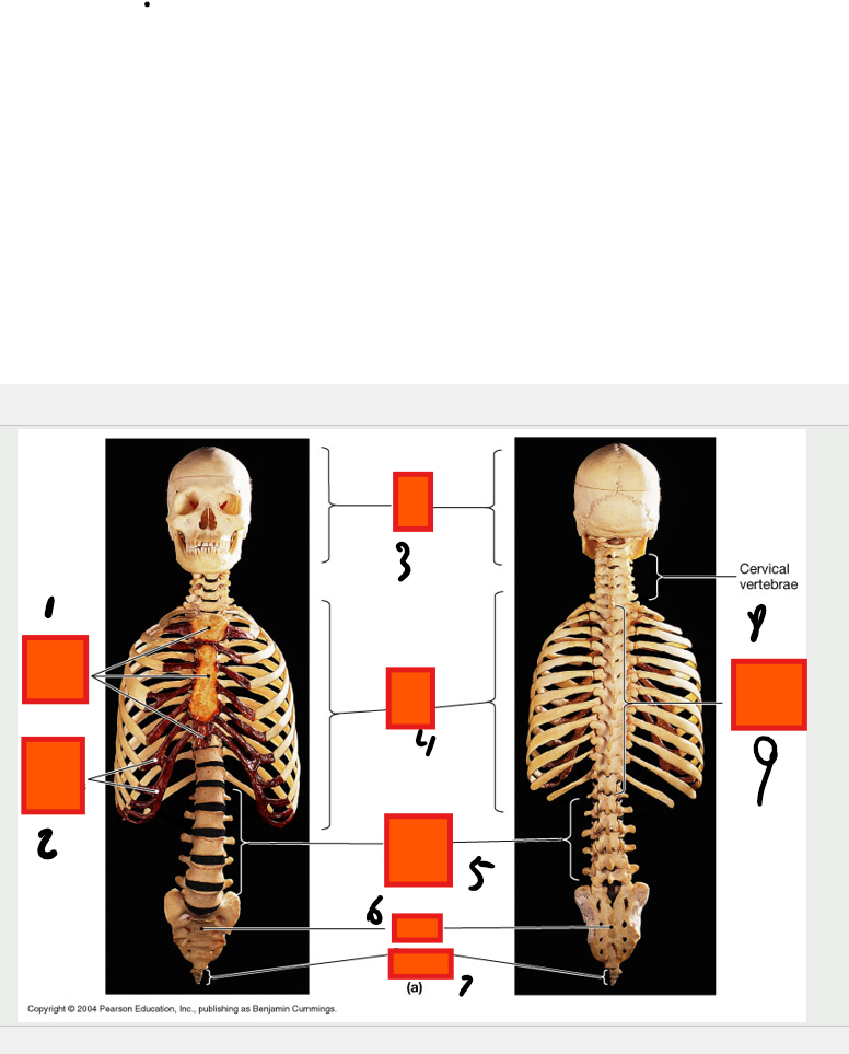 <p>cervical vertebrae</p>