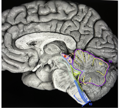 <p>What is the red dot?</p>
