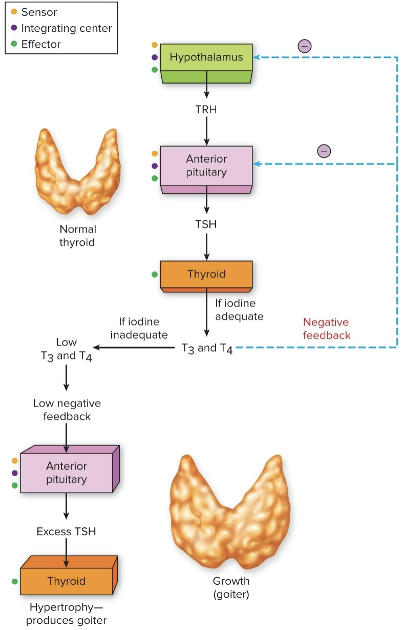<p>How Iodine Deficiency Causes a Goiter (enlargement of the thyroid gland in the neck)- what can it lead too</p>