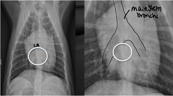 <p>Located between main stem bronchi which straddle it like a cowboy</p>
