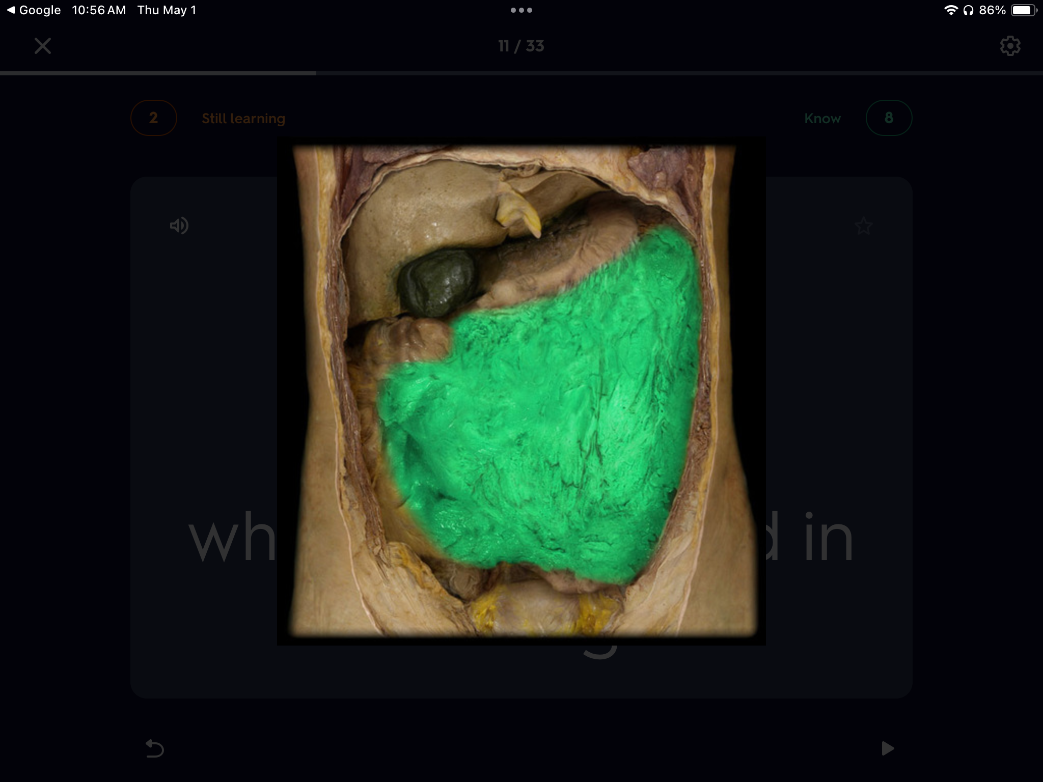 <p>What is the name of this highlighted structure that sheets and protects the abdominal organs?</p>