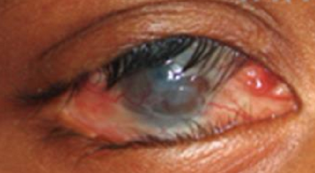 <p>What condition is this?</p>
