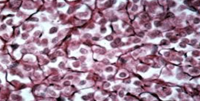 <p>A type of connective tissue that forms a supportive framework for organs, composed of a network of reticular fibers and cells. It is commonly found in lymphoid tissues, bone marrow, and the spleen. </p>