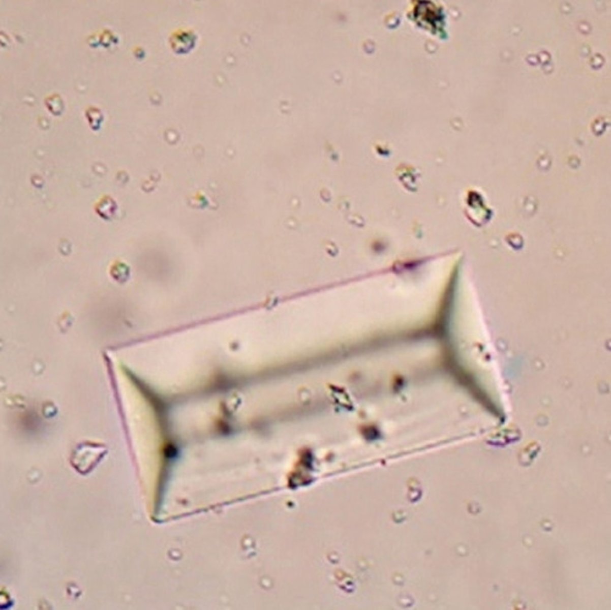 <p>What is being shown histologically?</p>