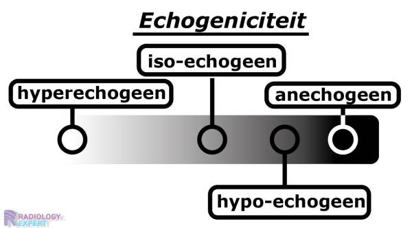 <ul><li><p>obv geluidsgolven</p><ul><li><p>akoestische impendantie = weerstand die geluidsgolf ondervindt door weefsel heen</p><ul><li><p>meer reflectie = witter</p></li></ul></li><li><p>kleur op echo</p><ul><li><p>hyperechogeen = wit (<span style="color: rgb(245, 149, 10)">bot, lucht</span>)</p></li><li><p>iso-echogeen = grijs</p></li><li><p>hypo-echogeen = donkergrijs</p><ul><li><p><strong><em>slagschaduw </em></strong>= hypo-echogeen door sterk reflecterende structuur</p></li></ul></li><li><p>anechogeen = zwart (<span style="color: rgb(250, 151, 10)">vocht</span>)</p></li></ul></li></ul></li><li><p>indicaties = abdomen, skelet (oa artritis), hart/vaten, hersenen neonaat</p></li><li><p>voordelen = goedkoop/snel, real time/dynamisch, pijnloos/niet invasief, géén straling/contrast</p></li><li><p>nadelen = tot beperkte diepte, limitaties lucht/bot/vet (moeilijker bij obesitas)</p></li></ul><p></p>
