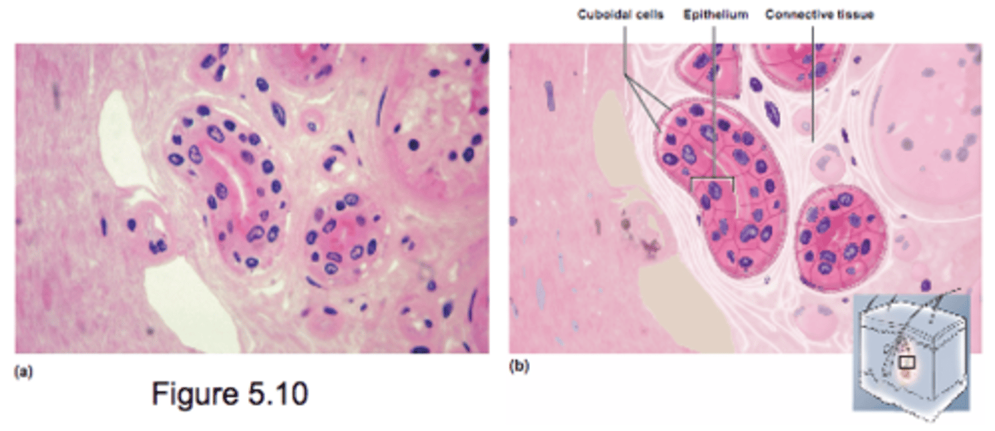 <p>- 2 or more cell layers</p><p>- surface cells square or round</p><p>- uncommon</p><p>- seen in glands</p>