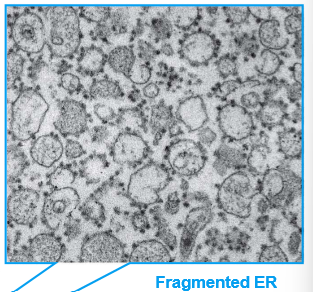 <ol><li><p><strong>Low Speed Centrifugation</strong>: Pellet→ whole cells, nuclei, and cytoskeletons.</p></li><li><p><strong>Medium SC</strong>: Pellet→ mitochondria, lysosomes, peroxisomes</p></li><li><p><strong>High SC:</strong> Pellet→ microsomes, small vesicles. WE SNATCH THESE FAST</p></li><li><p><strong>Very High Speed</strong>: Pellet→ ribosomes, viruses, large macromolecules</p></li></ol><p></p>