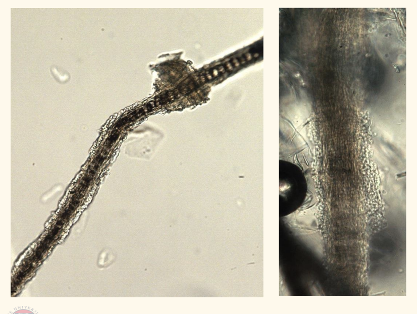 <p>What is wrong with these hairs? </p>