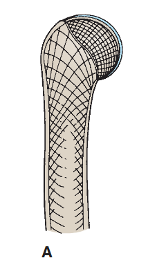 <p>found in limbs (humerus, femur, metacarpals/tarsals. phalanges)</p><p>tubular shaft, diaphysis, and ephyisis</p><p></p><p>growth</p><ul><li><p>epiphysis separates by epiphyseal cartilage</p></li><li><p>metaphysis = lies between  diaphysis</p></li><li><p>central marrow cavity with bone marrow</p></li><li><p>periosteum = connective tissue sheath covering the outer compact bone</p></li></ul><p></p>