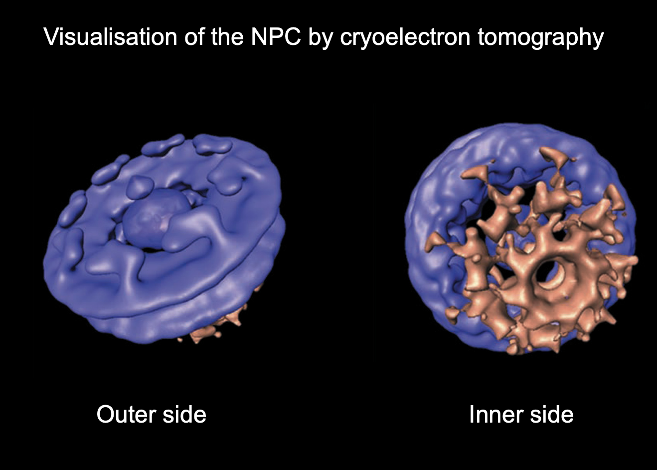 <p>The nuclear pore is 40nm BUT only 9nm can diffuse through→ MUST be some kind of gate in the centre:</p><p></p><p>Protein structure lining and occupying the central gate of the NPC:</p><ul><li><p>consists of nucleoporin proteins</p><ul><li><p>very rich in repeats f the 2 hydrophobic amino acids phenylalanine and glycine (FG)</p></li><li><p>FG repeats can interact with each other and form a<strong> dynamic hydrogel</strong></p><ul><li><p>there are several models postulated about this strucutre</p></li></ul></li></ul></li></ul><p></p><p>OUTER→ has a central gate n the middle→ somehthing blocking entry/exit</p><p>INNER→ shows the rigid opens in the inner side of the basket</p>
