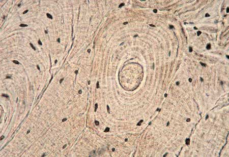 <p>Concentric circles around a central canal, Bone cells surrounded by lacunae. Function is to strengthen and support. Found in the outer portion of flat bones, Shafts of long bones</p>