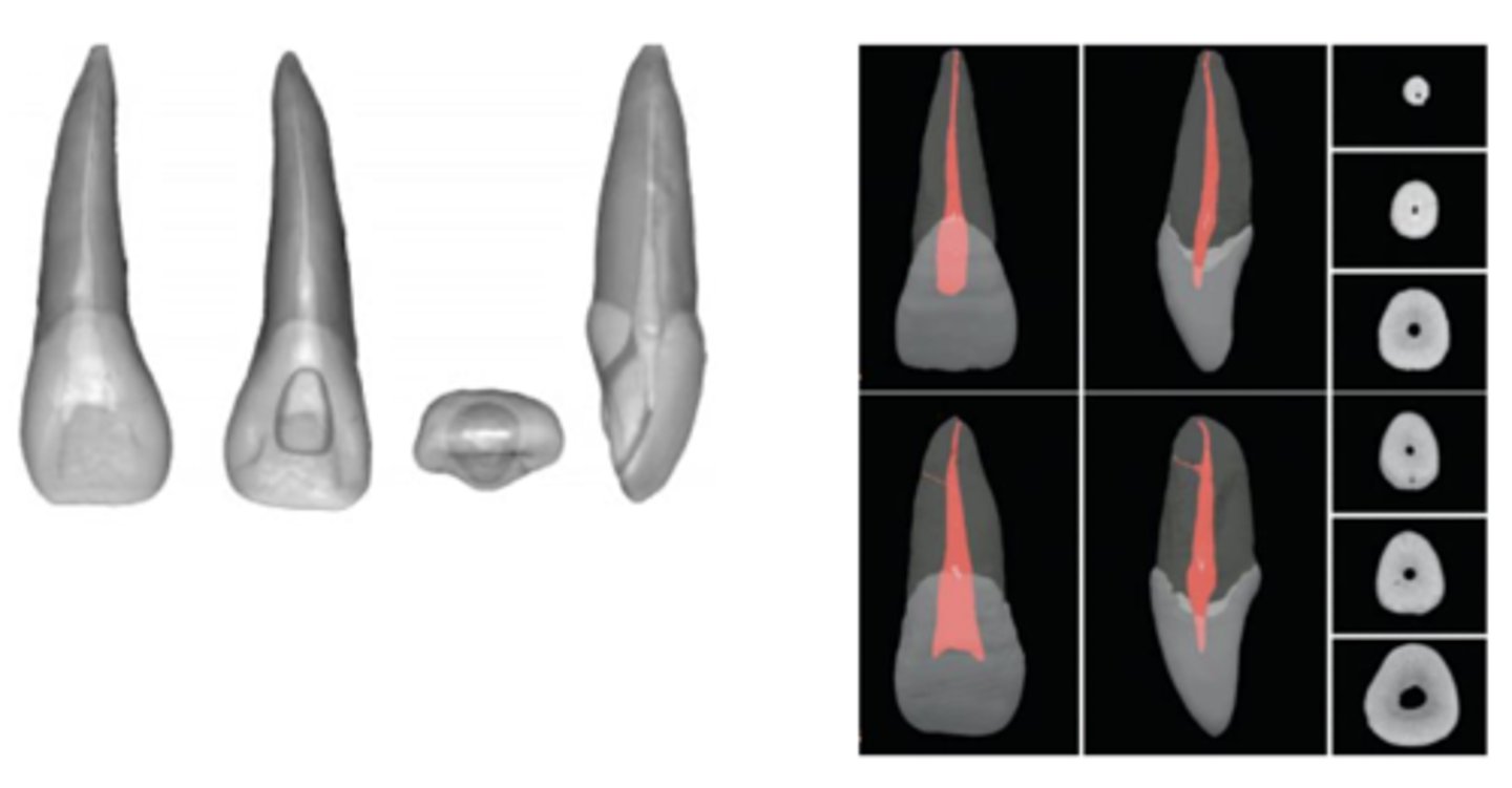 <p>triangular</p>