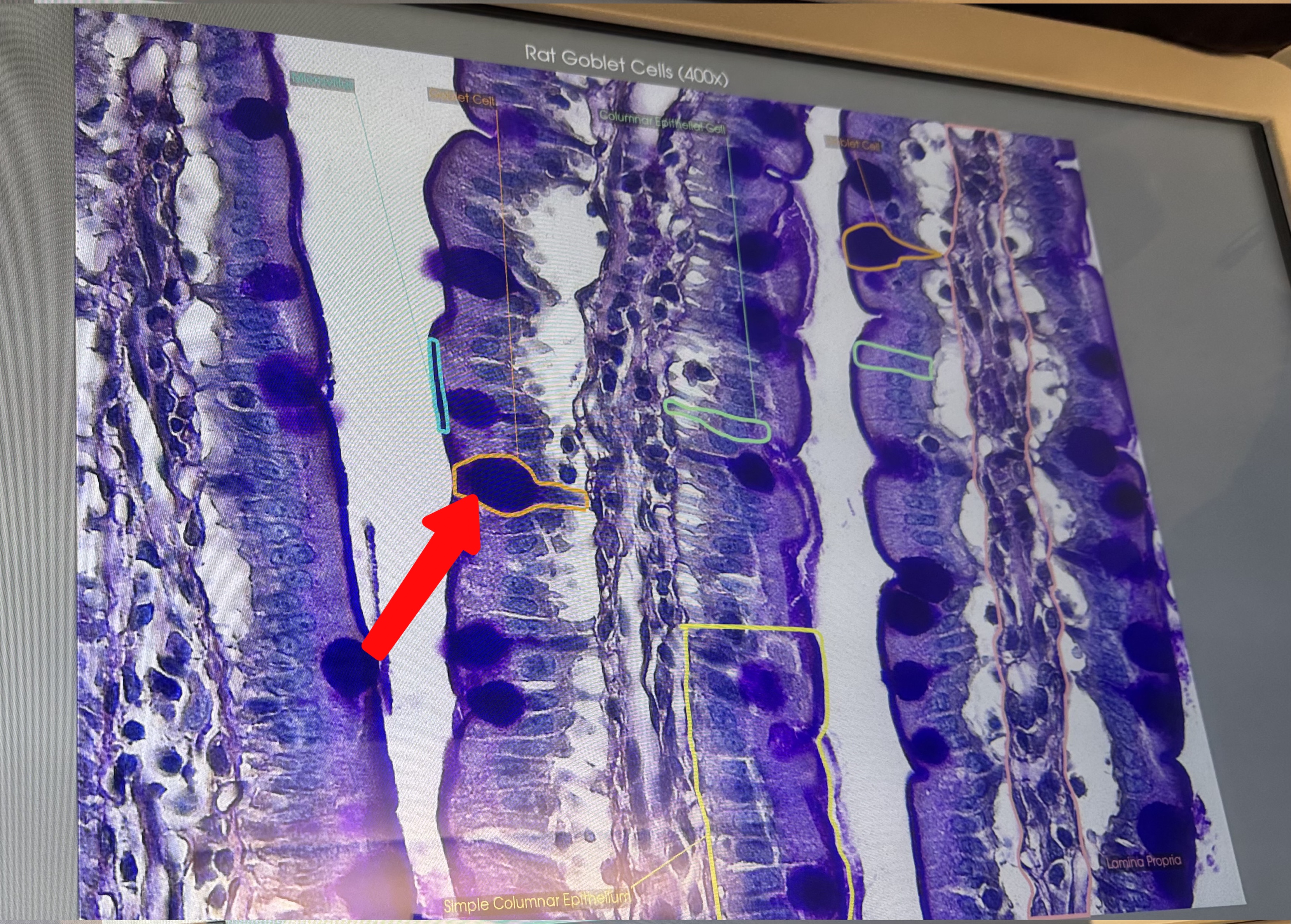 <p>Small intestine 400x (#10068): what is this structure</p>