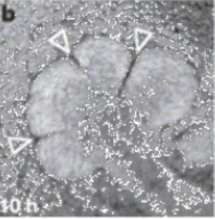 <p>connective tissue critical to the process of these CLEFTs forming</p>