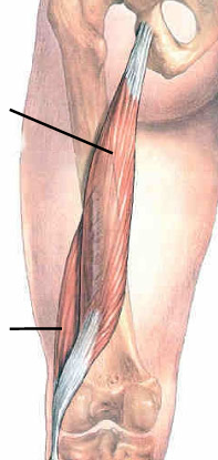 <p>name Top Line; origin/insertion</p>