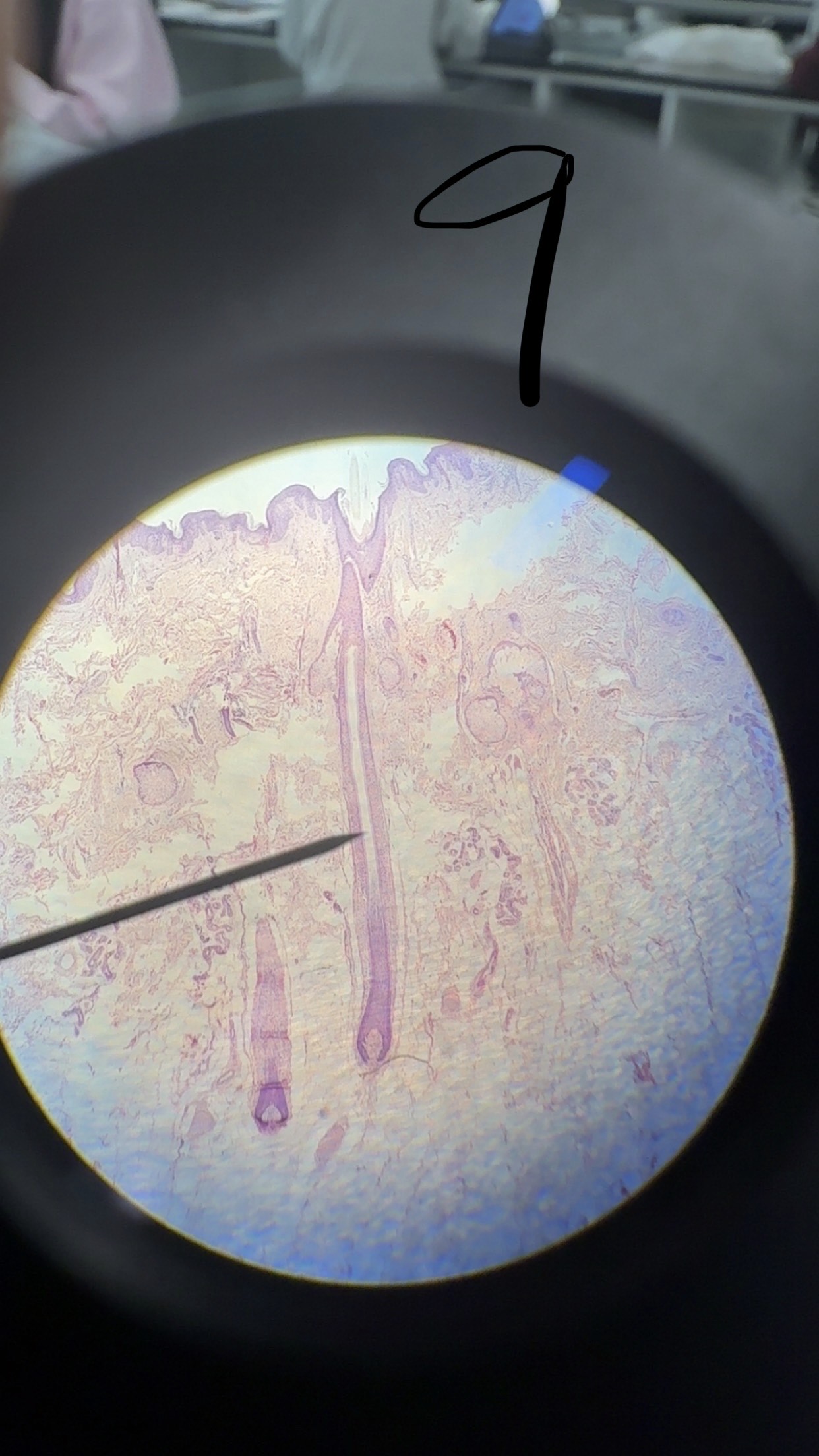 <p>Sebaceous gland</p>