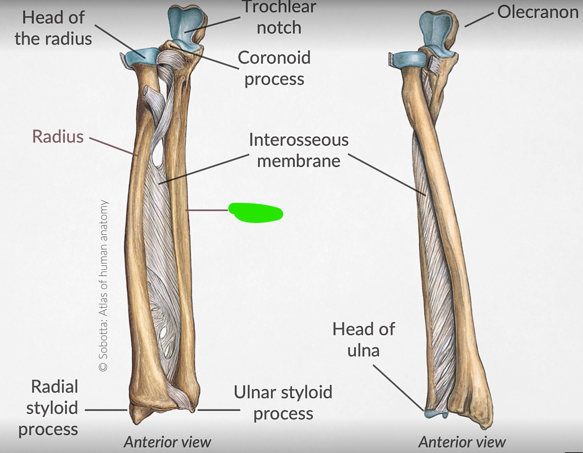 term image