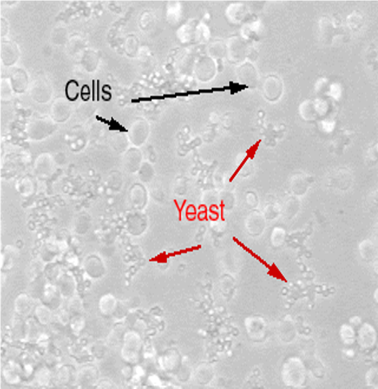 <p><span>Appear as round or ovoid particles;</span></p><p style="text-align: left"></p><p><span>May be seen to ‘bud’ from other particles or form short chains</span></p><p></p>