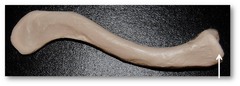Name this specific part of the clavicle.