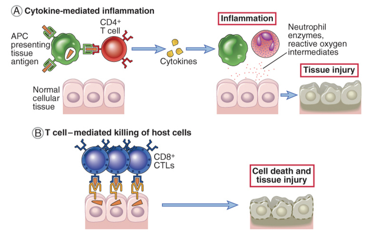 <p><span><span>T cells may cause tissue injury and disease by two mechanisms:</span></span></p><ul><li><p><span><span>Inflammation may be triggered by cytokines produced mainly by CD4+&nbsp;T cells and in which tissue injury is caused by activated macrophages and inflammatory cells; APC, Antigen-presenting cell.&nbsp;</span></span></p></li><li><p><span><span>Direct killing of target cells is mediated by CD8+&nbsp;cytotoxic T lymphocytes (CTLs).&nbsp;</span></span></p></li></ul><p></p>