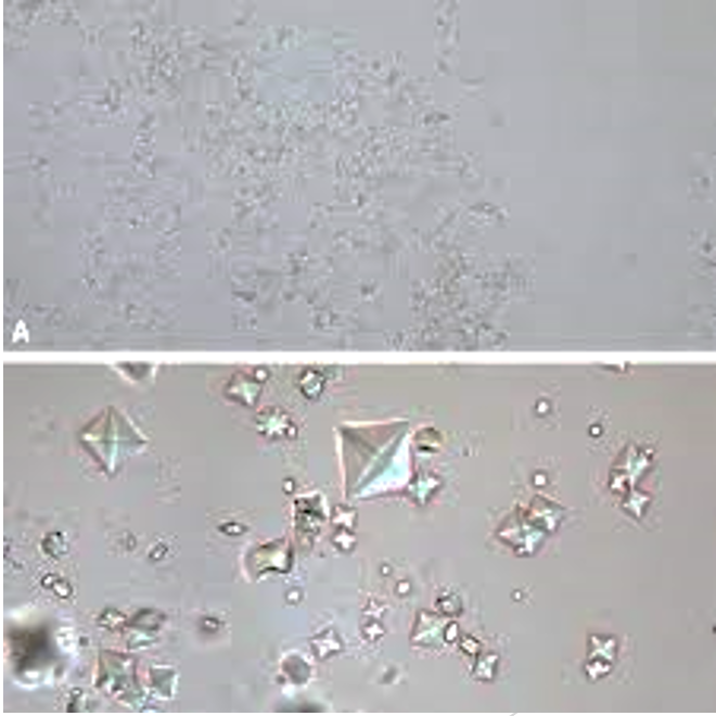 <p><span>Confirms presence of cholesterol, which forms a Maltese cross pattern with polarized light; also used on crystals</span></p>
