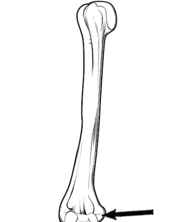 <p>What bone structure is this?</p>