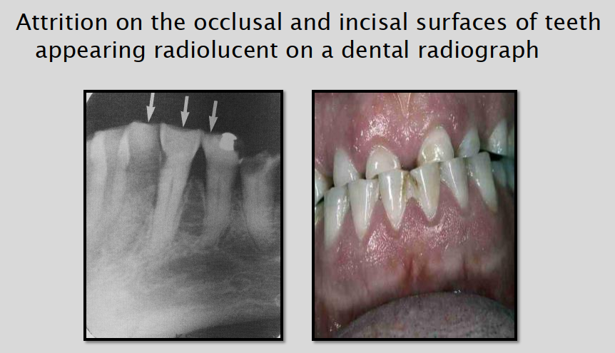 <p>We use clinical examination to differentiate. </p>