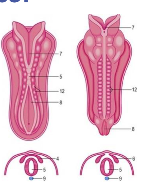 occurs 2-8 weeks 

days 18-26 (3 weeks) happens: 

* Ectoderm will start to fold and thicken forming a neural plate running along the dorsal side of the developing embryo
* neural plate folds to forms neural groove 
* edges fuse to form neural tube 
* cells that seperate from the neural tube form autonomic ganglia and most of PNS (neural crest) 