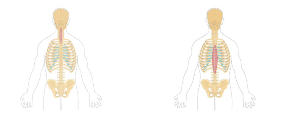 <p>Erector spinae group (Spinalis) </p>