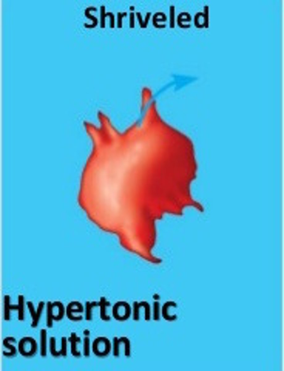 <p>Water comes out of the cell without being replenished causing it to shrink</p><p>no enough water</p>