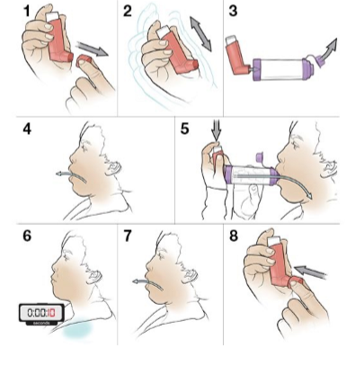 <p>that big wonky thing that I used. helps get around coordinated breathing</p>