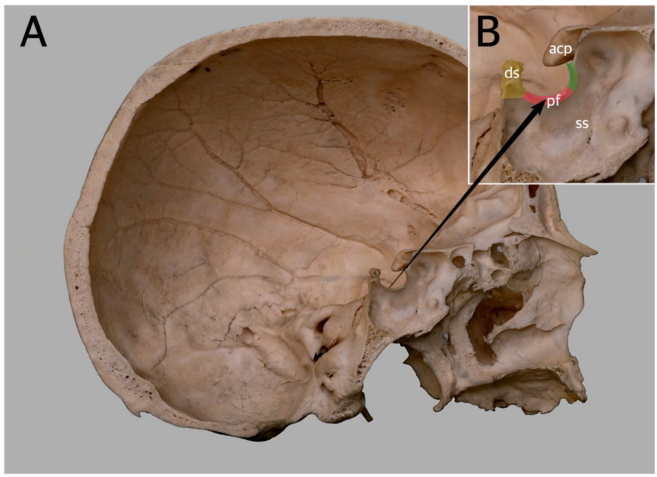 <p>“turkish saddle” - central area that holds the pituitary gland</p>