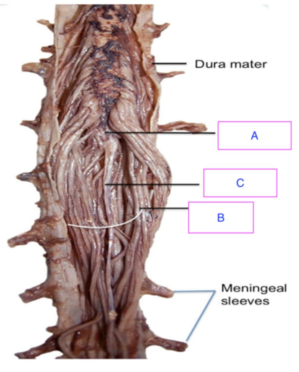 <p>ID structure (A)</p><p>- cord like structure in the middle</p>