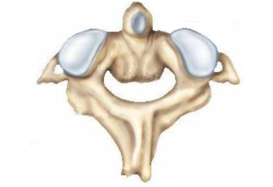The specific vertebra shown in the figure is the