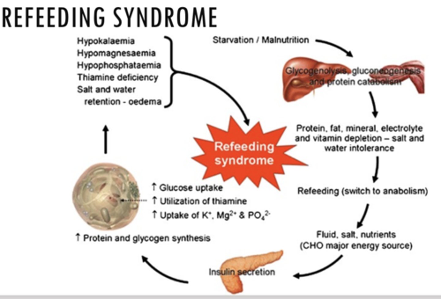 <p>- can take place w/i first few days of refeeding, cardiac complications w/i the first week and delirium </p><p>- calorie repletion should be given slowly, particularly the first week at about 20 kcal/kg of body weight per day </p>