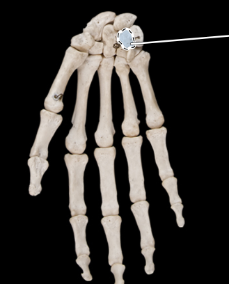 <p>bones of the hand, anterior view, right side</p>