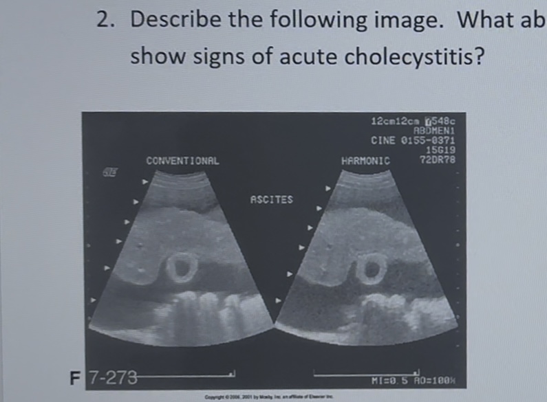 <p>describe the image like you were going to chart</p>
