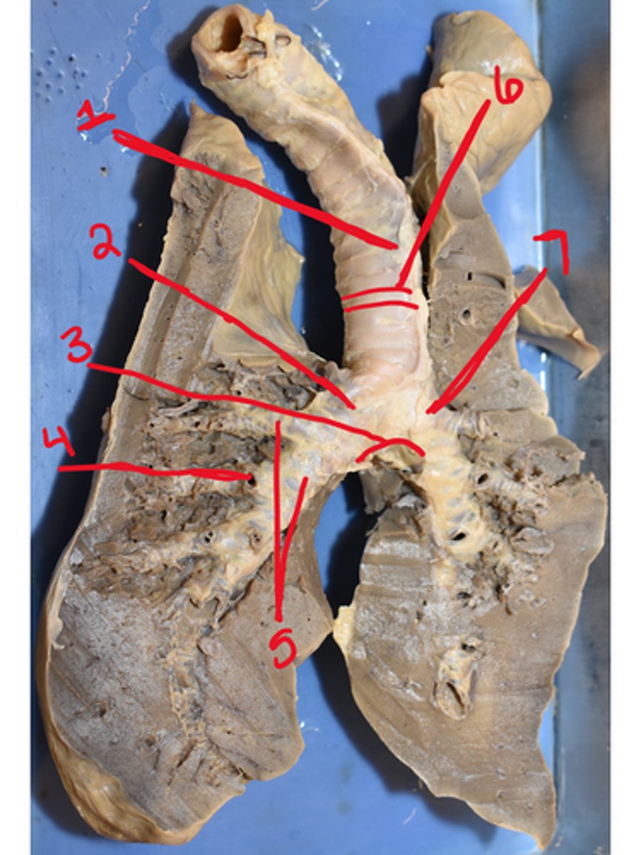 <p>What is structure #5</p>
