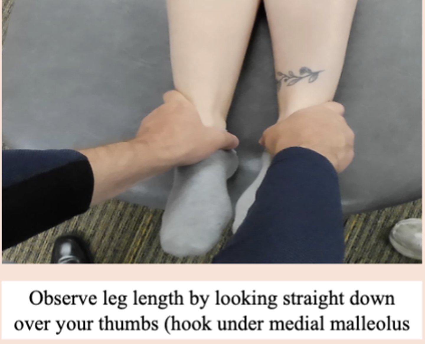 <p>- used to identify anterior vs posterior innominate</p><p>- posterior = short to long</p><p>- anterior = long to short</p>