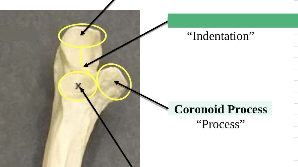 <p>Coronoid Process </p>