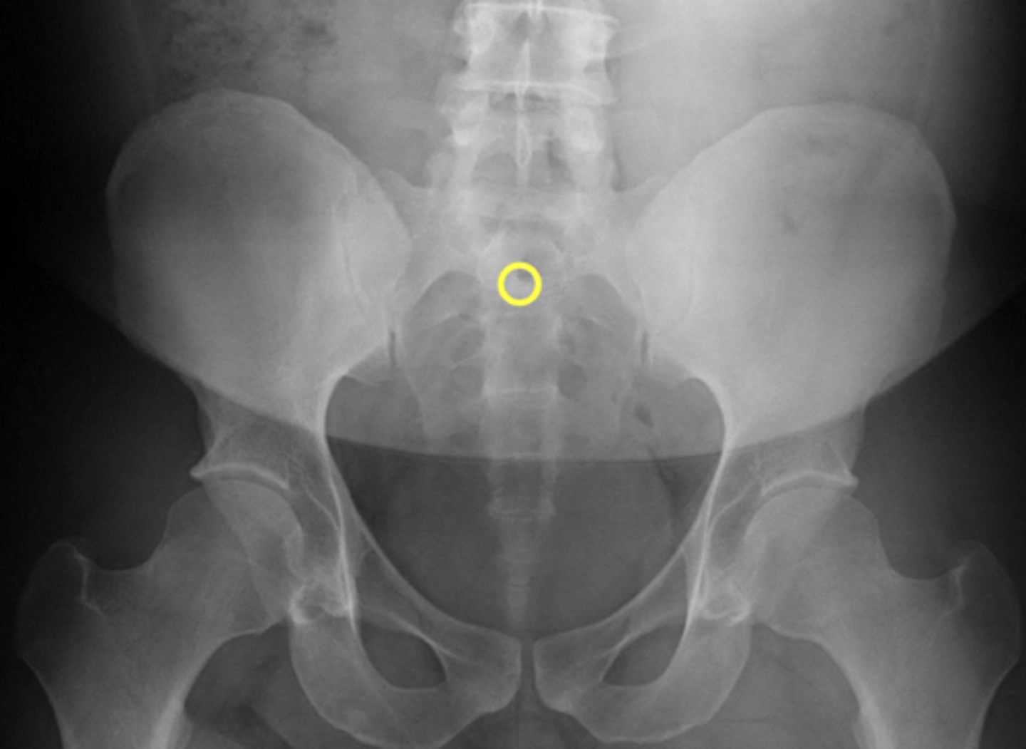 <p>What is the yellow circle?</p>