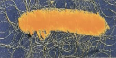 <p>“Peri” = arounds</p>