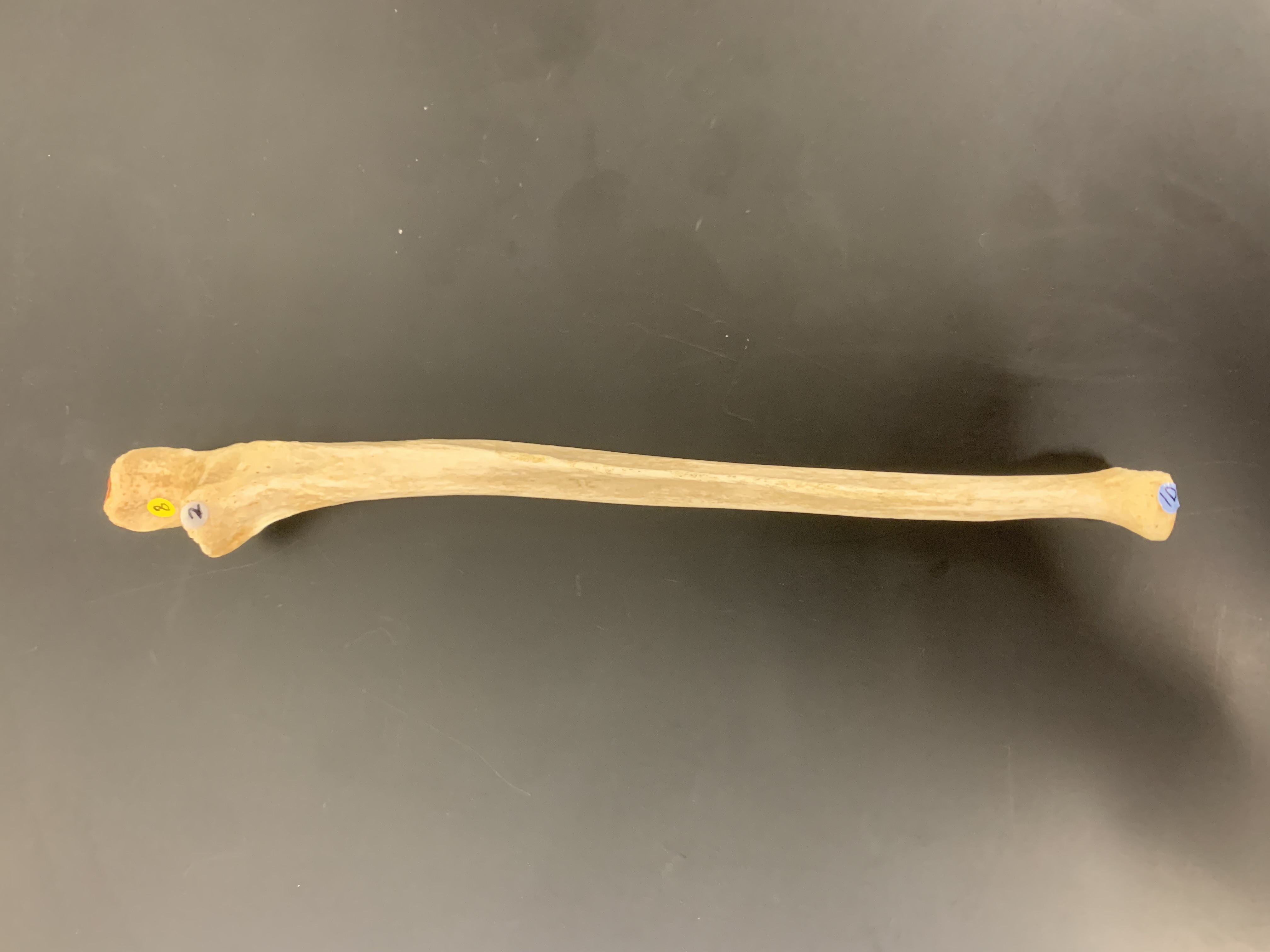 <p>Trochlear Notch</p>