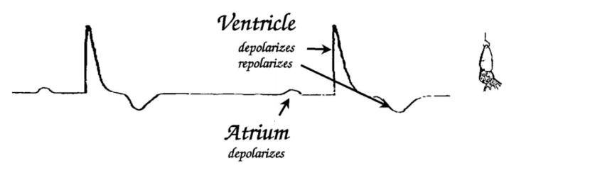 <ol><li><p>Lose the plateau as cells die off</p><ul><li><p>Recodring becomes more <strong>extracellular</strong> in form</p></li></ul></li></ol><p>but</p><ol start="2"><li><p>Ventrical de and re- polarisation are still obvisous as dominant electrical events</p></li><li><p>Small event before ventricular dep→ <strong>depolarisation of atria</strong></p></li></ol><p></p><p></p><p></p>