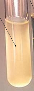 <p>What physical nature of culture media is this? is it Turbid or Clear?</p>